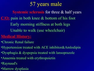 57 years male Systemic sclerosis  for three & half years C/O:   pain in both knee & bottom of his foot Early morning stiffness at both legs Unable to walk (use wheelchair) Medical History: Chronic Renal failure Hypertension treated with ACE inhibitor&Amlodipin Dysphagia & dyspepsia treated with lansoprazole Anaemia treated with erythropoietin Raynaud's  Marrow dysplasia 