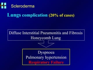 Scleroderma Lungs  complication  (20% of cases) Dyspnoea Pulmonary hypertension Respiratory Failure Diffuse Interstitial Pneumonitis and Fibrosis Honeycomb Lung 