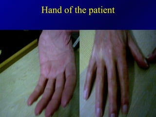 Hand of the patient 