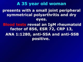 A 35 year old woman presents with a small joint peripheral symmetrical polyarthritis and dry eyes. Blood tests  reveal an IgM rheumatoid factor of 856, ESR 72, CRP 13, ANA 1:1280, anti-SSA and anti-SSB positive.  