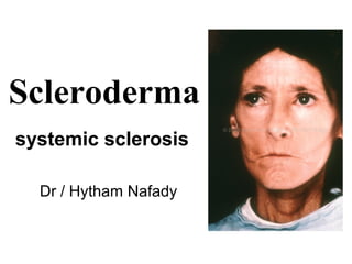 Scleroderma
systemic sclerosis
Dr / Hytham Nafady
 