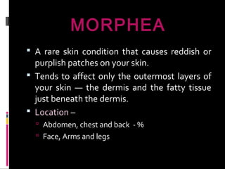 MORPHEA
 A rare skin condition that causes reddish or
purplish patches on your skin.
 Tends to affect only the outermost layers of
your skin — the dermis and the fatty tissue
just beneath the dermis.
 Location –
 Abdomen, chest and back - %
 Face, Arms and legs
 