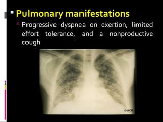  Pulmonary manifestations
 Progressive dyspnea on exertion, limited
effort tolerance, and a nonproductive
cough
 