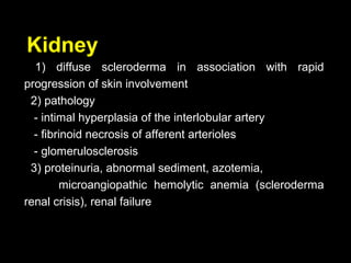 Kidney
1) diffuse scleroderma in association with rapid
progression of skin involvement
2) pathology
- intimal hyperplasia of the interlobular artery
- fibrinoid necrosis of afferent arterioles
- glomerulosclerosis
3) proteinuria, abnormal sediment, azotemia,
microangiopathic hemolytic anemia (scleroderma
renal crisis), renal failure
 