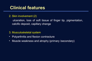 Scrofuloderma Presentation Scleroderma | PPT
