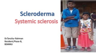 Scleroderma
Dr.Tanzilur Rahman
Resident,Phase-B,
BSMMU
yasin
Esha
 