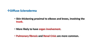 Scleroderma | PPTX
