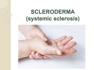 SCLERODERMA
(systemic sclerosis)
 