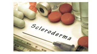 Scleroderma