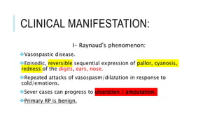 CLINICAL MANIFESTATION:
I- Raynaud's phenomenon:
Vasospastic disease.
Episodic, reversible sequential expression of pallor, cyanosis,
redness of the digits, ears, nose.
Repeated attacks of vasospasm/dilatation in response to
cold/emotions.
Sever cases can progress to ulceration / amputation.
Primary RP is benign.
 