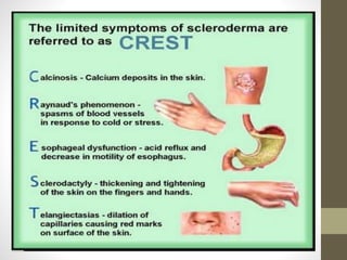 Sleroderma Rash Scleroderma and Your Skin | PPTX