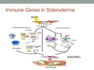 Immune Genes in Scleroderma 
 