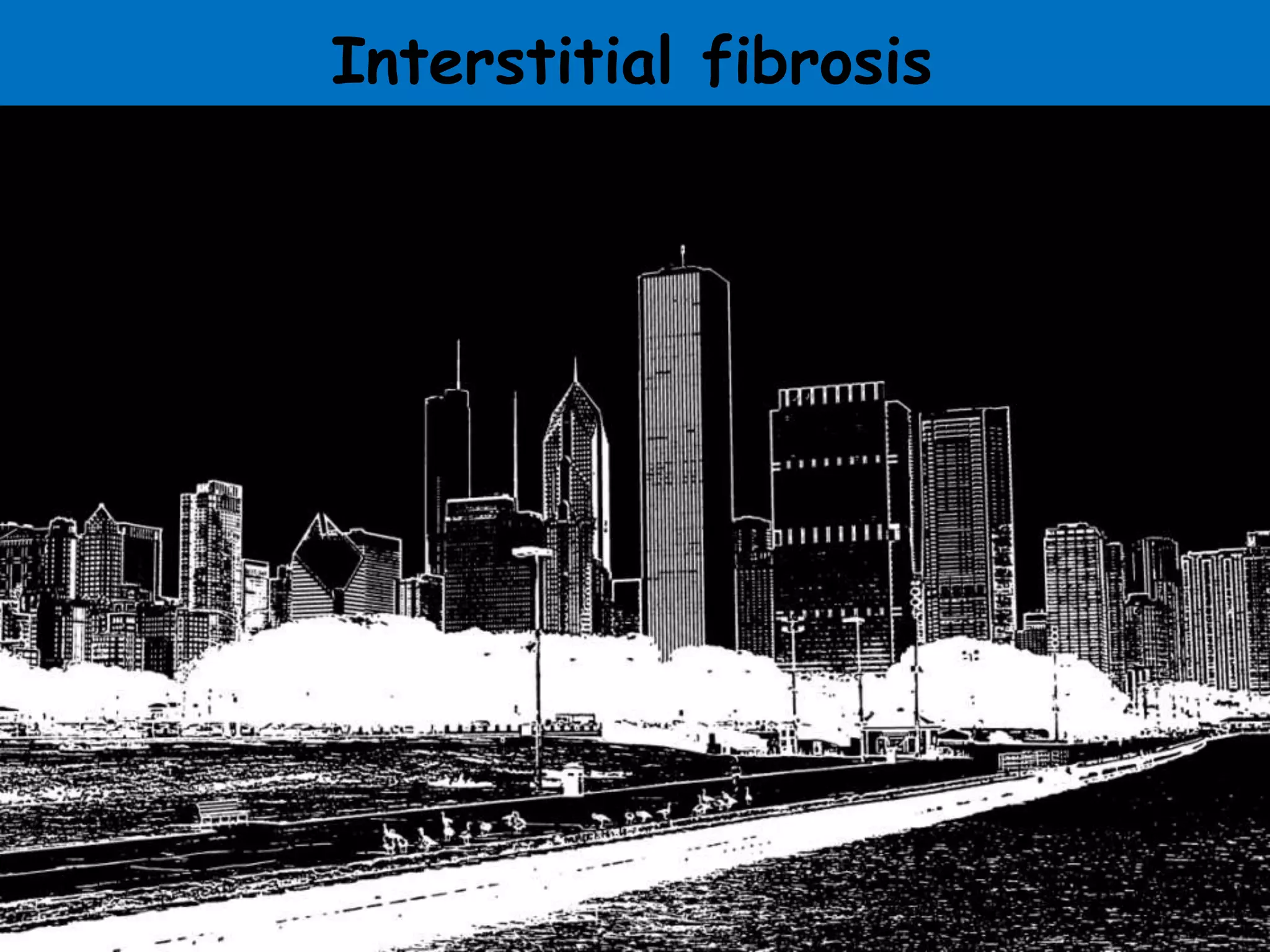 Interstitial fibrosis
 