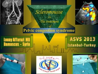 03/19/15 1
Scleromousse
In
The treatment
of
Pelvic congestion syndrome
 