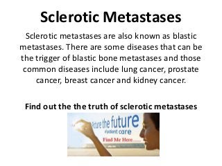 Sclerotic Metastases
  Sclerotic metastases are also known as blastic
metastases. There are some diseases that can be
the trigger of blastic bone metastases and those
 common diseases include lung cancer, prostate
     cancer, breast cancer and kidney cancer.

 Find out the the truth of sclerotic metastases
 
