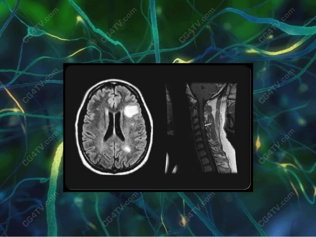 Embryo Group Puzzled Scleroza Multipla Carti Free Download Whisksandwit Com
