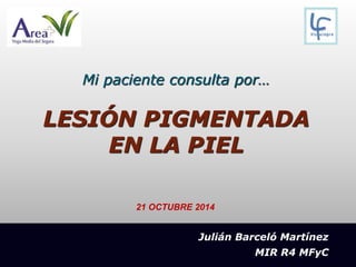 Mi paciente consulta por…
LESIÓN PIGMENTADA
EN LA PIEL
Julián Barceló Martínez
MIR R4 MFyC
21 OCTUBRE 2014
 