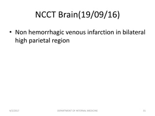 NCCT Brain(19/09/16)
• Non hemorrhagic venous infarction in bilateral
high parietal region
4/2/2017 DEPARTMENT OF INTERNAL MEDICINE 31
 