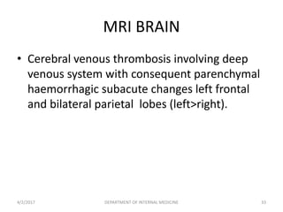 MRI BRAIN
• Cerebral venous thrombosis involving deep
venous system with consequent parenchymal
haemorrhagic subacute changes left frontal
and bilateral parietal lobes (left>right).
4/2/2017 DEPARTMENT OF INTERNAL MEDICINE 33
 
