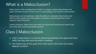 Class I Malocclusion
 Class I malocclusion is a normal relationship between the upper and lower
teeth, but may have spacing and/or crowding
 The mesial cusp of the upper first molar rests in the lower first molars
deepest curvature
What is a Malocclusion?
Malocclusion is the misalignment of teeth or irregular relationship between the
upper and lower arches as they come to a physiological rest position (natural bite).
Malocclusion can be hereditary, make the ability to masticate (chew food) more
difficult, effect speech and oral hygiene and lead to shortening the life of the
adjacent tooth structures.
Centric Occlusion: When the molar teeth are closed and touching and teeth & jaw
are in the most unstrained/relaxed position
 