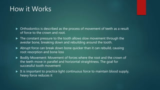 How it Works
 Orthodontics is described as the process of movement of teeth as a result
of force to the crown and root.
 The constant pressure to the tooth allows slow movement through the
aveolar bone, breaking down and rebuilding around the tooth.
 Abrupt force can break down bone quicker than it can rebuild, causing
root resorption and bone loss
 Bodily Movement: Movement of forces where the root and the crown of
the teeth move in parallel and horizontal straightness. The goal for
successful tooth movement
 It is important to practice light continuous force to maintain blood supply,
heavy force reduces it
 