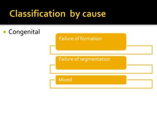  Congenital
Failure of formation
Failure of segmentation
Mixed
 