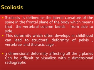  Scoliosis is defined as the lateral curvature of the
spine in the frontal plane of the body which means
that the vertebral column bends from side to
side.
 This deformity which often develops in childhood
can lead to structural deformity of pelvis ,
vertebrae and thoracic cage .
 3 dimensional deformity affecting all the 3 planes
Can be difficult to visualize with 2 dimensional
radiographs
 