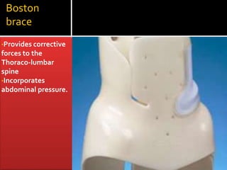 Boston
brace
•Provides corrective
forces to the
Thoraco-lumbar
spine
•Incorporates
abdominal pressure.
 