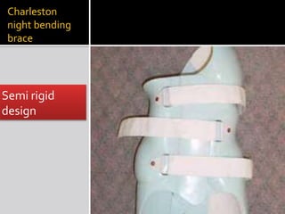 Charleston
night bending
brace
Semi rigid
design
 