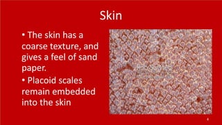 Skin
• The skin has a
coarse texture, and
gives a feel of sand
paper.
• Placoid scales
remain embedded
into the skin
4
 