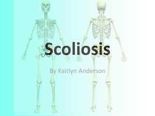 Scoliosis
By Kaitlyn Anderson
 