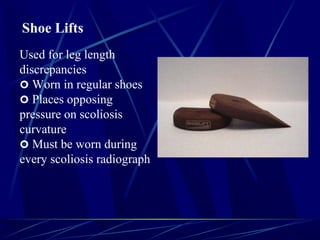 Scoliosis | PPT | Physical Therapy | Wellness