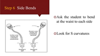 Side Shift Method Scoliosis.pptx