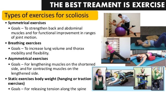 SEARCH AND BUY THIS PRODUCT Scoliosis (Spine Disorder)