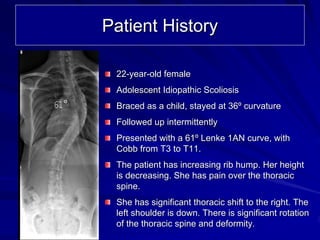Patient History

       22-year-old female
       Adolescent Idiopathic Scoliosis
61°    Braced as a child, stayed at 36º curvature
       Followed up intermittently
       Presented with a 61º Lenke 1AN curve, with
       Cobb from T3 to T11.
       The patient has increasing rib hump. Her height
       is decreasing. She has pain over the thoracic
       spine.
       She has significant thoracic shift to the right. The
       left shoulder is down. There is significant rotation
       of the thoracic spine and deformity.
 
