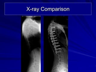 X-ray Comparison
 