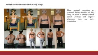 Side Shift Method Pathomechanics of Scoliosis and principles of management of scoliosis .pptx