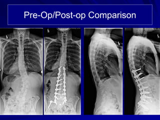 Pre-Op/Post-op Comparison
 