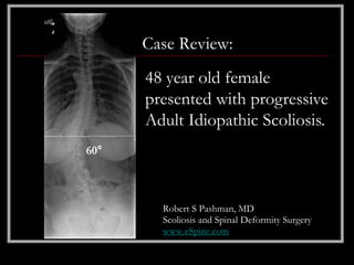 Case Review:
      48 year old female
      presented with progressive
      Adult Idiopathic Scoliosis.
60°



        Robert S Pashman, MD
        Scoliosis and Spinal Deformity Surgery
        www.eSpine.com
 