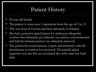 Patient History
• 29 year old female
• The patient is status post 3 operations from the age of 3 to 15.
• This was done in Estonia and then ultimately in Finland.
• She had a posterior spinal fusion for adolescent idiopathic
  scoliosis that ultimately got infected, was redone, reinstrumented
  and half the instrumentation was ultimately removed.
• The patient has noted increase of pain and deformity with rib
  prominence as rotation has increased. The painful apical
  segments over the ribs are associated also with some low back
  pain.
 