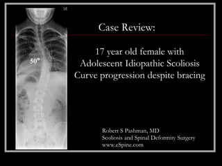 Case Review:

          17 year old female with
50°    Adolescent Idiopathic Scoliosis
      Curve progression despite bracing




             Robert S Pashman, MD
             Scoliosis and Spinal Deformity Surgery
             www.eSpine.com
 