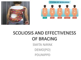 Scoliosis and effectiveness of bracing
