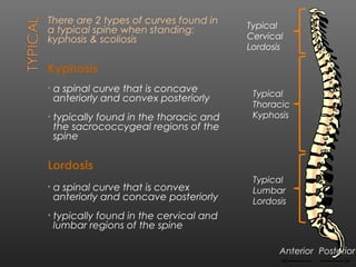 Scoliosis by aamir sharif | PPT