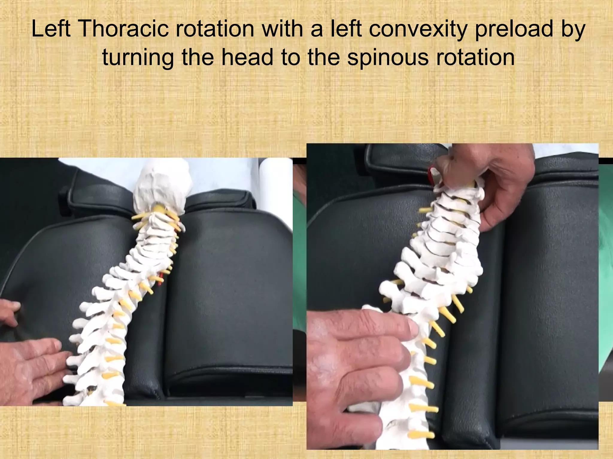 Side Shift Method Scoliosis correction | PPT