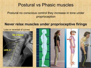Postural vs Phasic muscles
Postural no conscious control they increase in tone under
proprioception
Never relax muscles under proprioceptive firings
Loss or reversal of curves
 