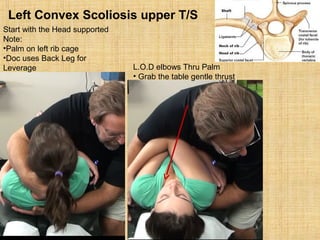 Start with the Head supported
Note:
•Palm on left rib cage
•Doc uses Back Leg for
Leverage L.O.D elbows Thru Palm
• Grab the table gentle thrust
Left Convex Scoliosis upper T/S
 
