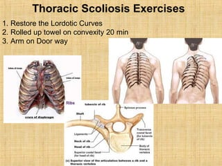 Thoracic Scoliosis Exercises
1. Restore the Lordotic Curves
2. Rolled up towel on convexity 20 min
3. Arm on Door way
 