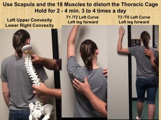 Left Upper Convexity
Lower Right Convexity
T1 /T2 Left Curve
Left leg forward
T3 /T6 Left Curve
Left leg forward
Use Scapula and the 18 Muscles to distort the Thoracic Cage
Hold for 2 - 4 min. 3 to 4 times a day
 