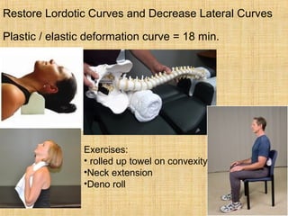 Restore Lordotic Curves and Decrease Lateral Curves
Plastic / elastic deformation curve = 18 min.
Exercises:
• rolled up towel on convexity
•Neck extension
•Deno roll
 