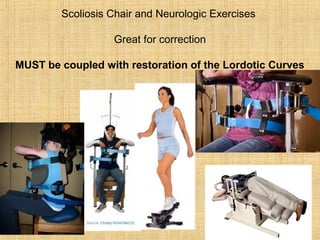 Scoliosis Chair and Neurologic Exercises
Great for correction
MUST be coupled with restoration of the Lordotic Curves
 